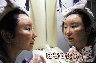 赴韩整容失败美女变丑，术后严重感染无法修复