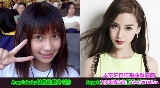 angelababy承认整容，黄晓明和angelababy，黄晓明激吻angelababy