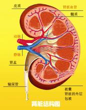 什么人会患尿毒症，哪些人容易患尿毒症