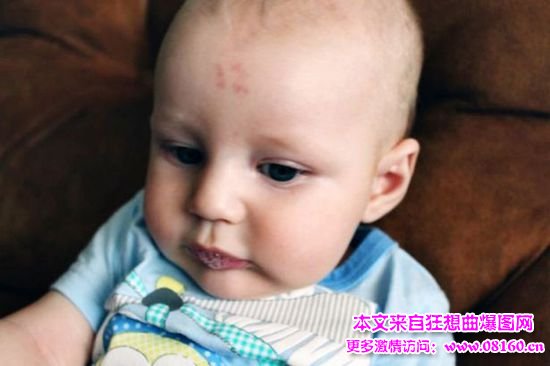 组图：南非新生婴儿额头现数字12 稀奇胎记震惊医生