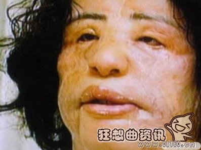 女子因整容太美遭暴打，打人者因整容失败而嫉妒