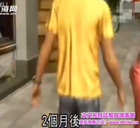 女子被狗咬伤变性饥渴身亡（图），或为狂犬病症状？